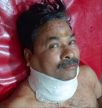 Unnao News: उधार सामान न देने पर दुकानदार की गर्दन पर मारा बांका, हालत गंभीर unnao news